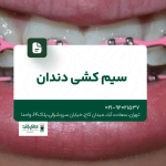 سیم کشی دندان