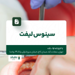 سینوس لیفت