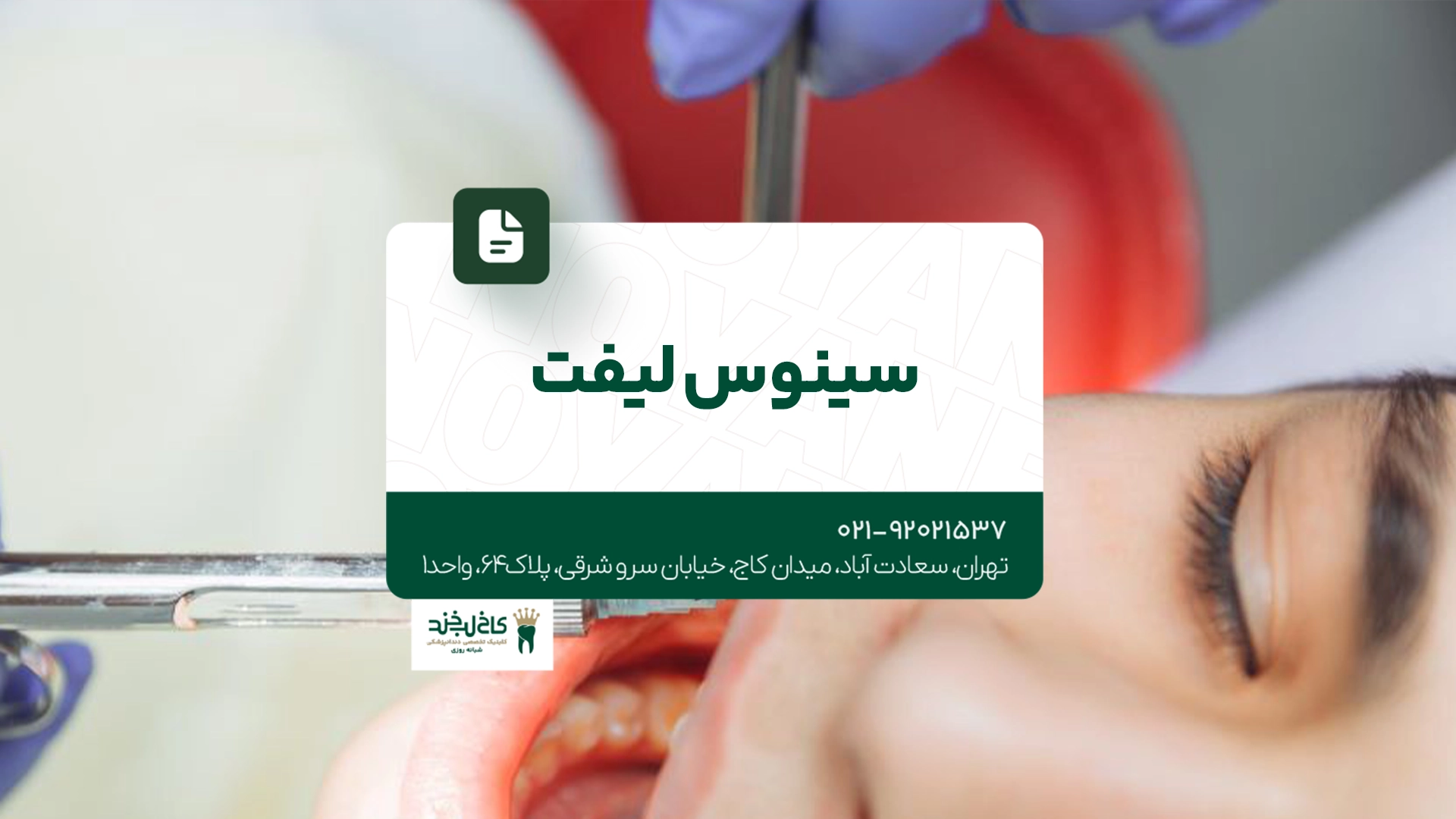 سینوس لیفت سینوس لیفت