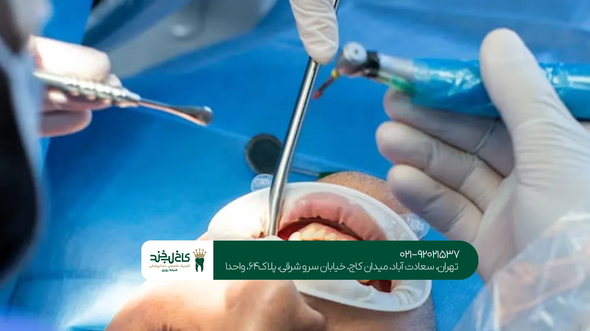انجام سینوس لیفت در تهران انجام سینوس لیفت در تهران
