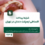 شرایط پرداخت اقساطی ایمپلنت در تهران