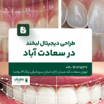 طراحی دیجیتال لبخند در سعادت آباد