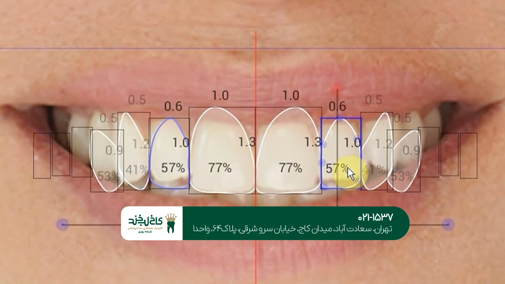 طرح لبخند