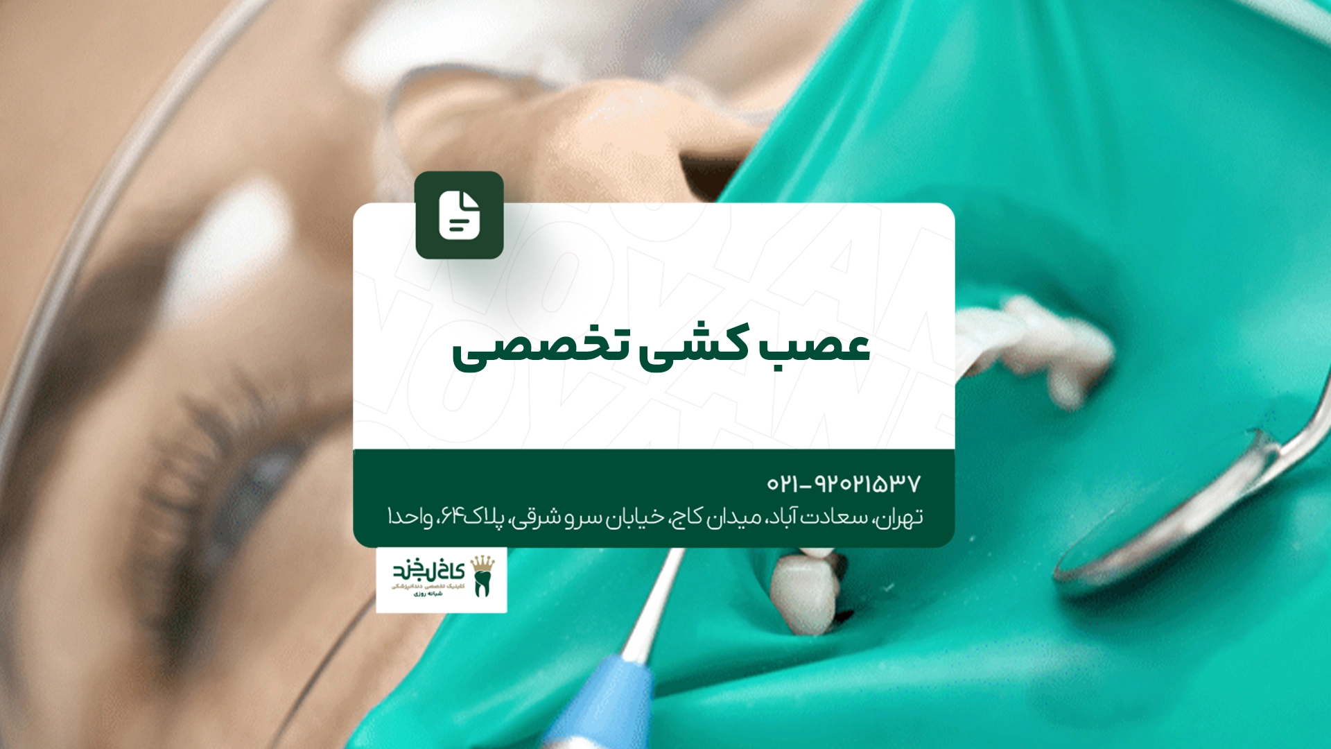 عصب کشی تخصصی عصب کشی تخصصی