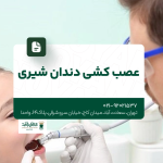 عصب کشی دندان شیری