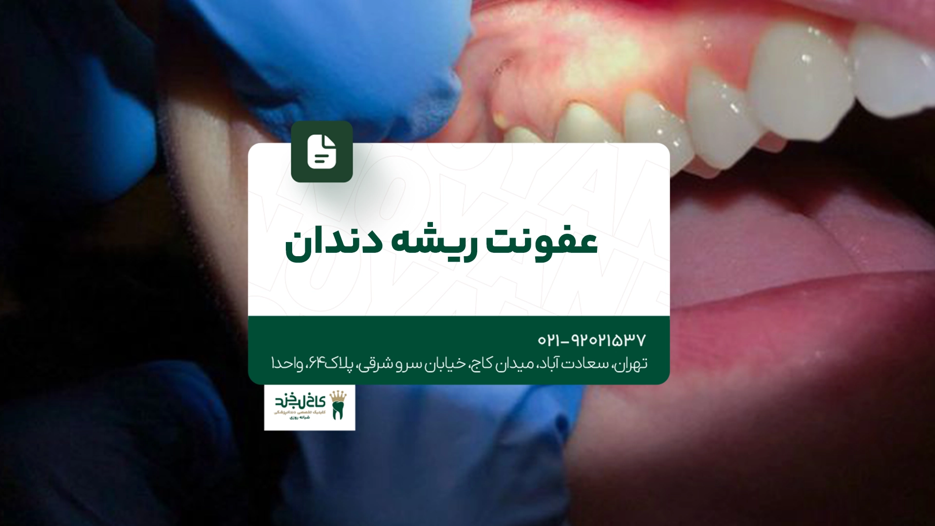عفونت ریشه دندان