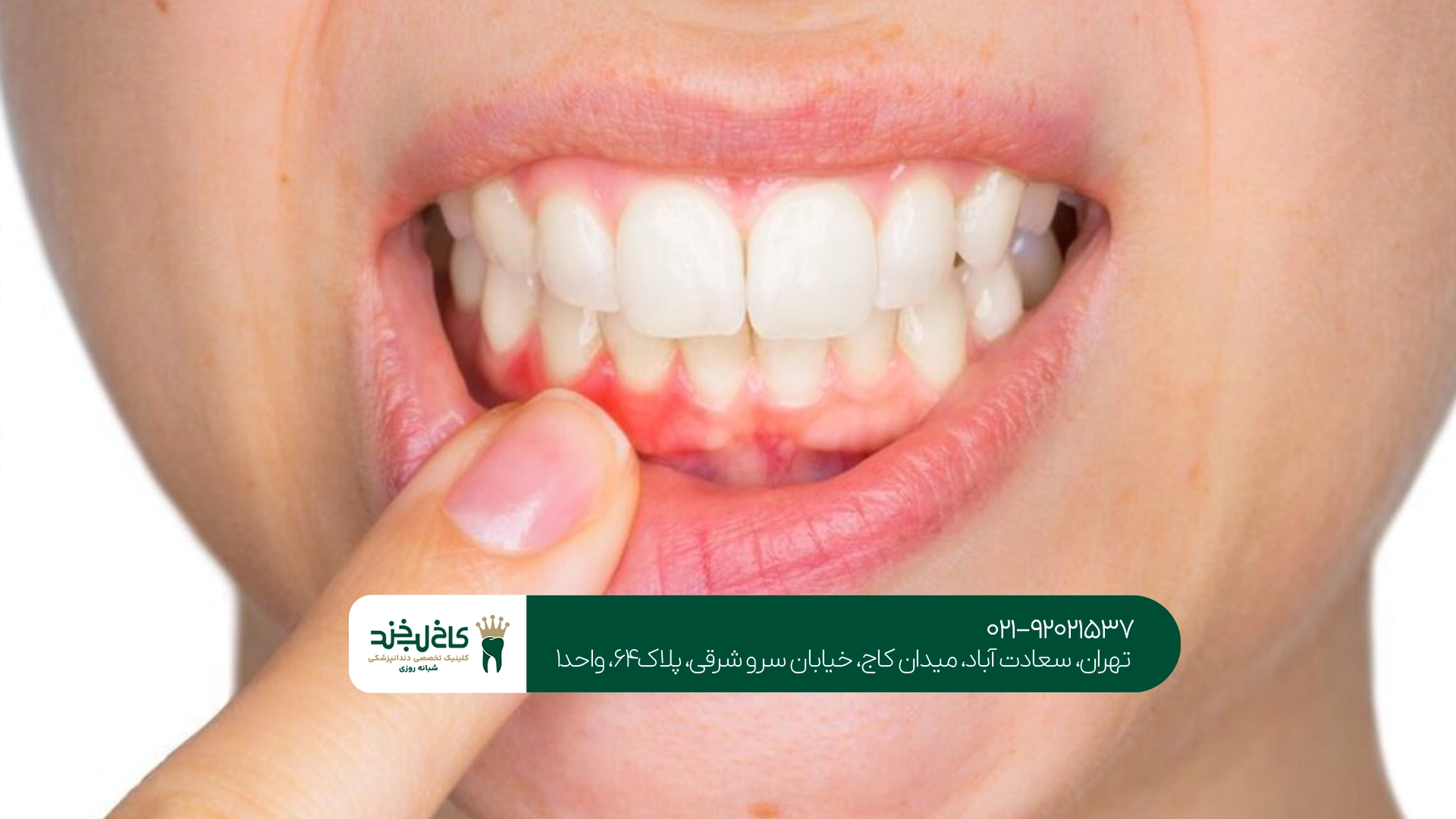 آیا عفونت ریشه دندان خطرناک است؟