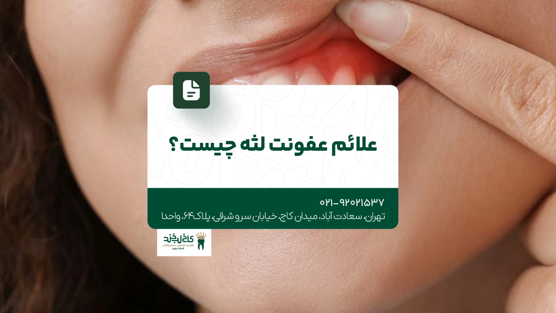 علائم عفونت لثه چیست