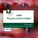 عوارض ایمپلنت دندان در سنین بالا