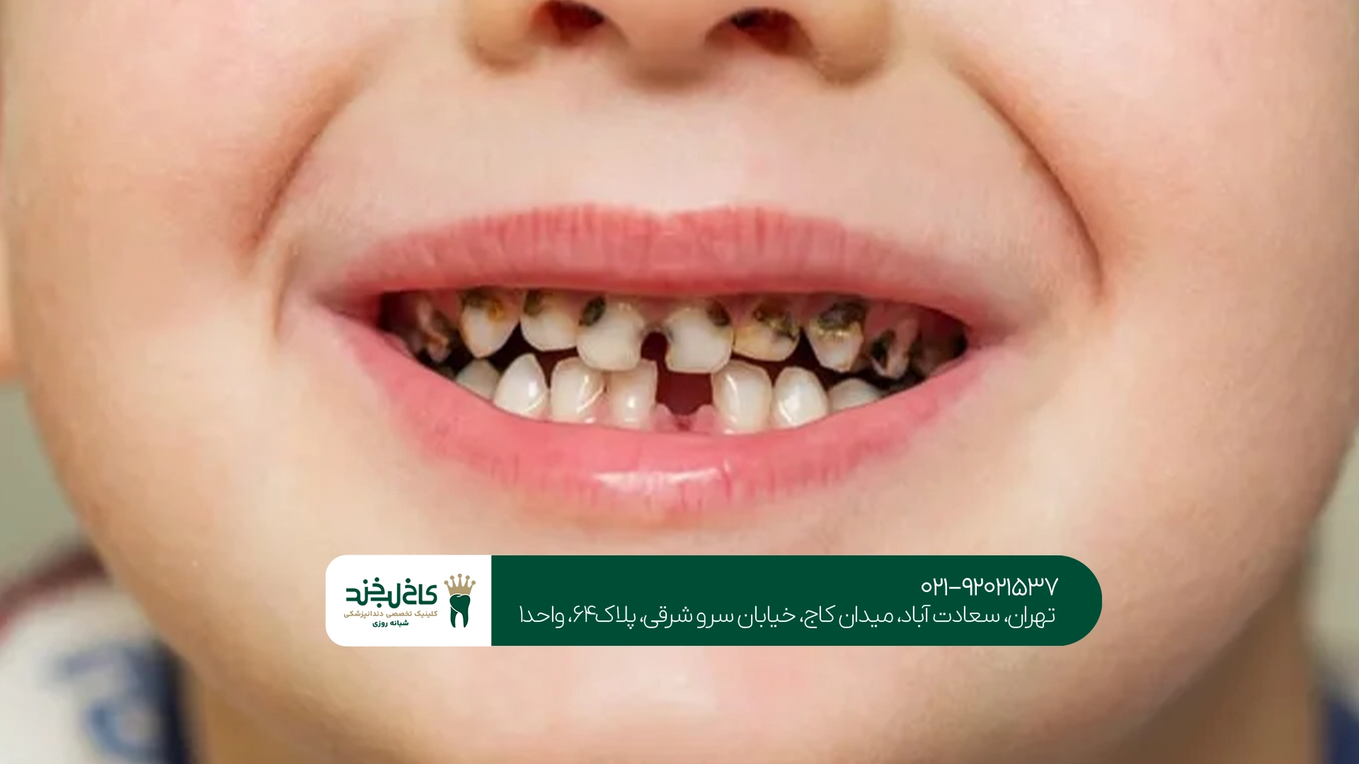 دندانپزشکی کودکان