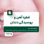 قطره آهن و پوسیدگی دندان