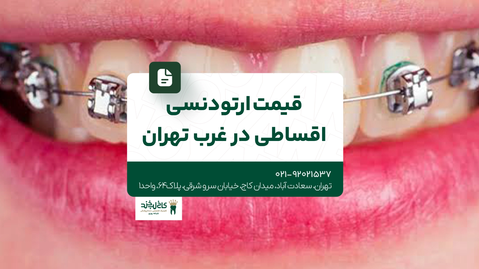 قیمت ارتودنسی اقساطی در غرب تهران