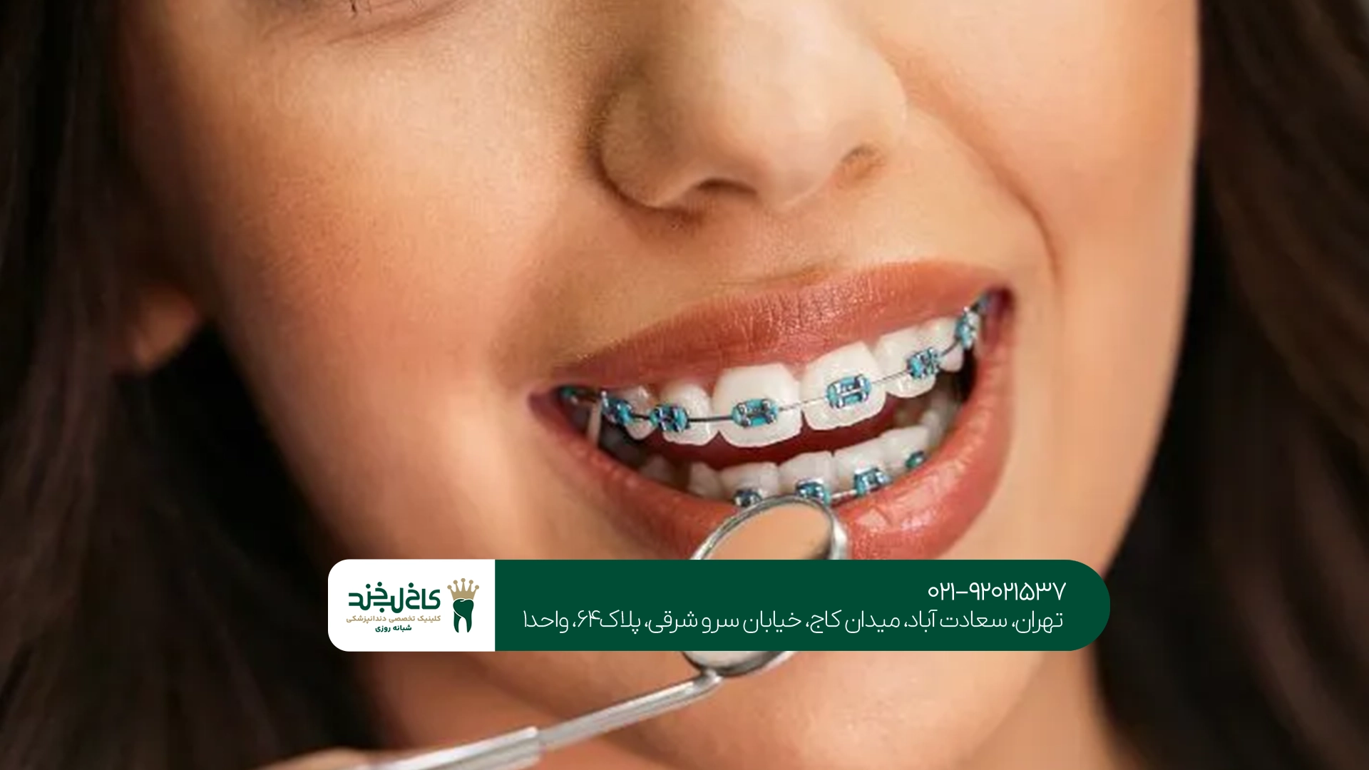 قیمت ارتودنسی اقساطی