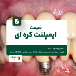 قیمت ایمپلنت کرهای