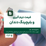 قیمت جرم گیری و بلیچینگ دندان