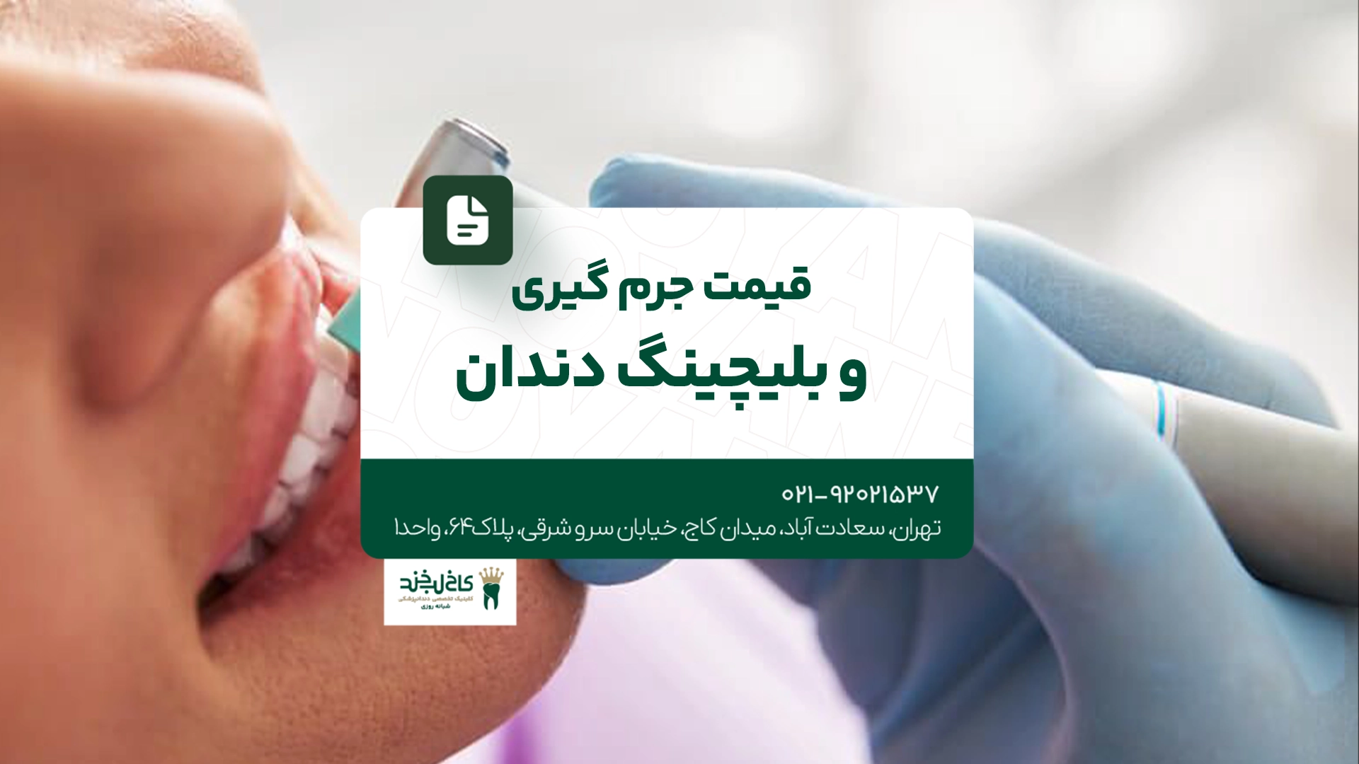 قیمت جرم گیری و بلیچینگ دندان