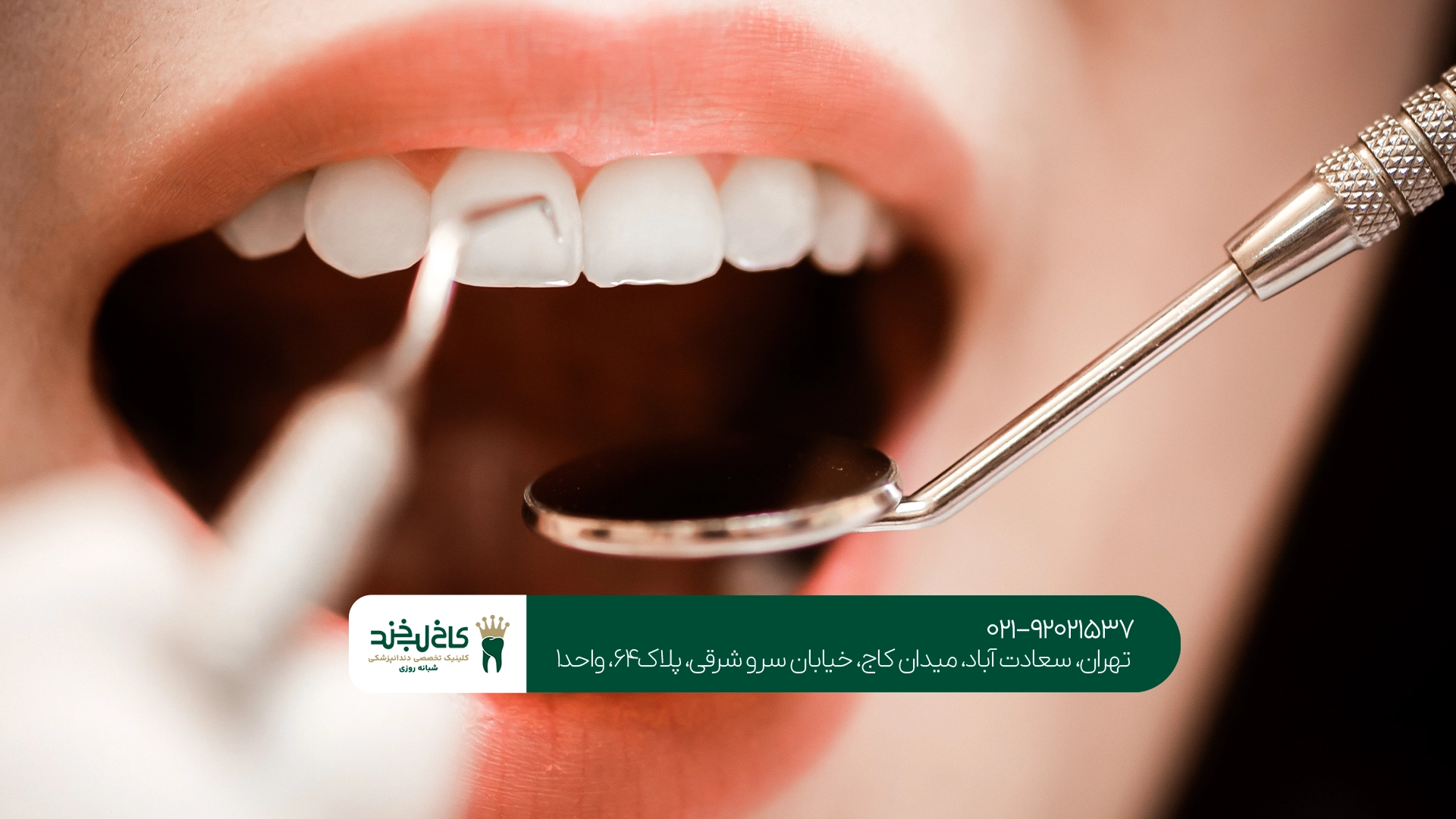 قیمت جرمگیری دندان چقدر است؟