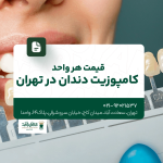 قیمت هر واحد کامپوزیت دندان