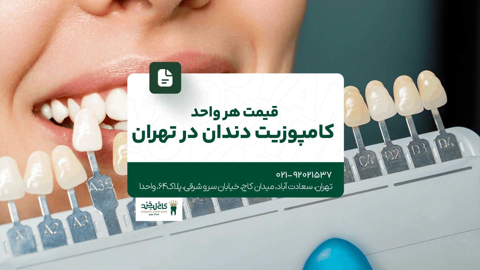 قیمت هر واحد کامپوزیت دندان قیمت هر واحد کامپوزیت دندان