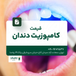 قیمت کامپوزیت دندان