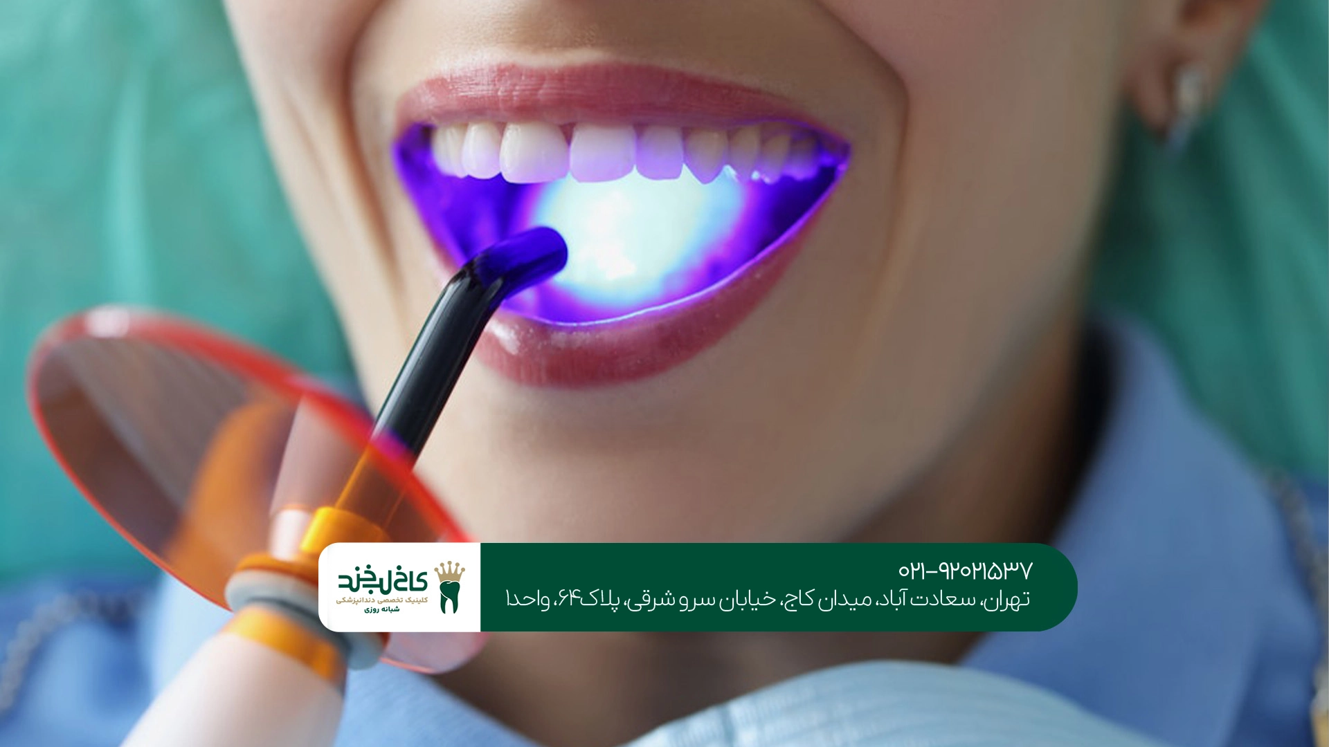 مرکز حرفهای کامپوزیت دندان
