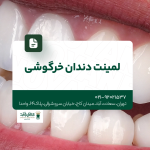 لمینت دندان خرگوشی