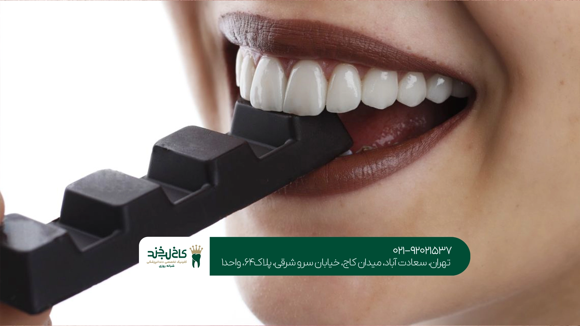 کلینیک لمینت دندان خرگوشی کلینیک لمینت دندان خرگوشی