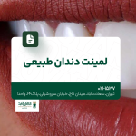 لمینت دندان طبیعی