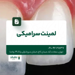 لمینت سرامیکی