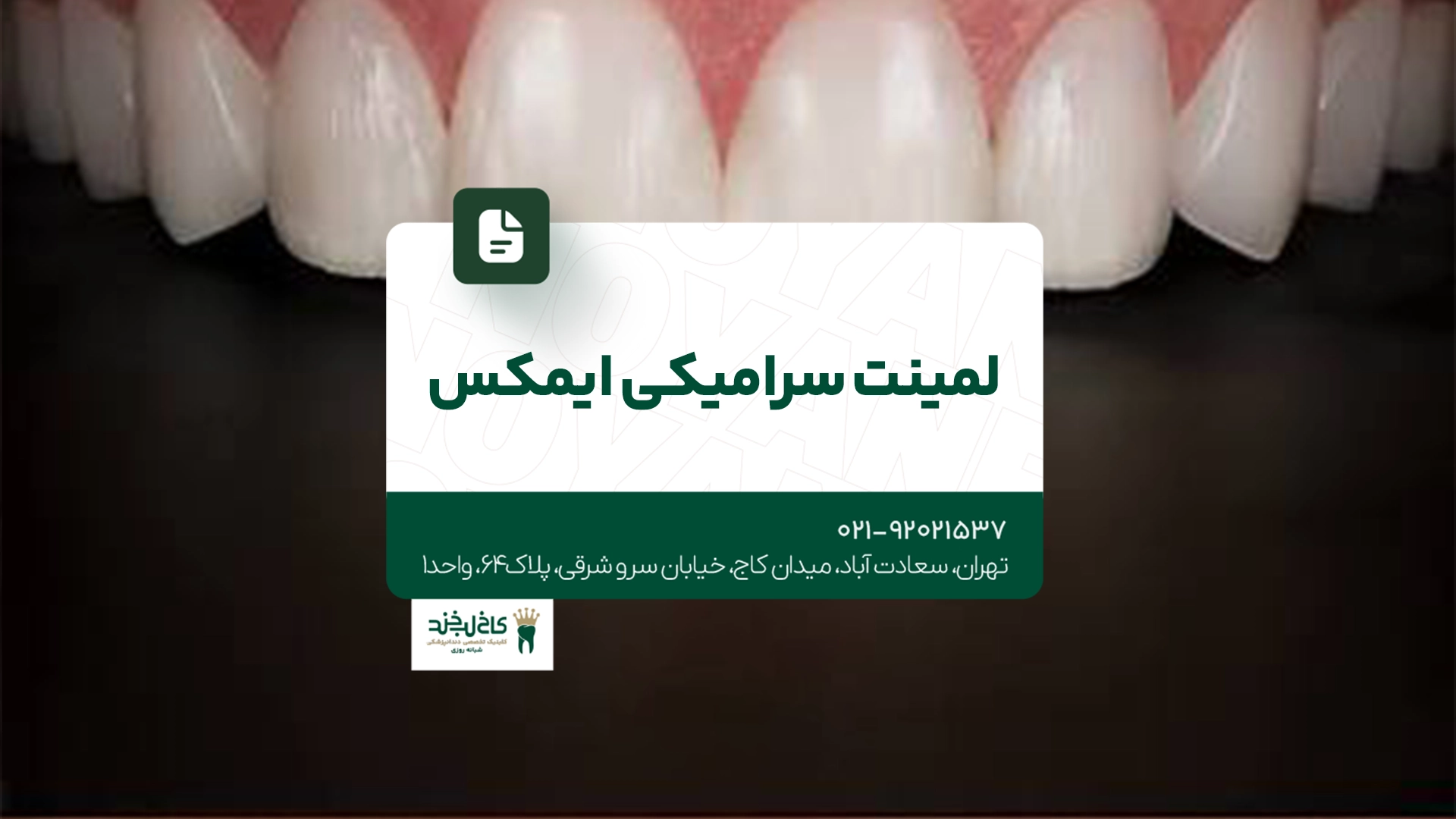 لمینت سرامیکی ایمکس