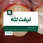 لیفت لثه