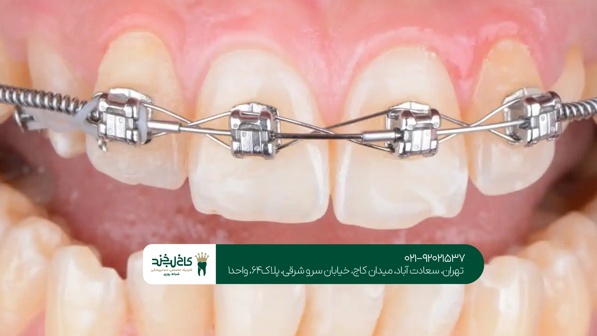 متخصص ارتودنسی خوب در تهران