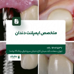 متخصص ایمپلنت دندان