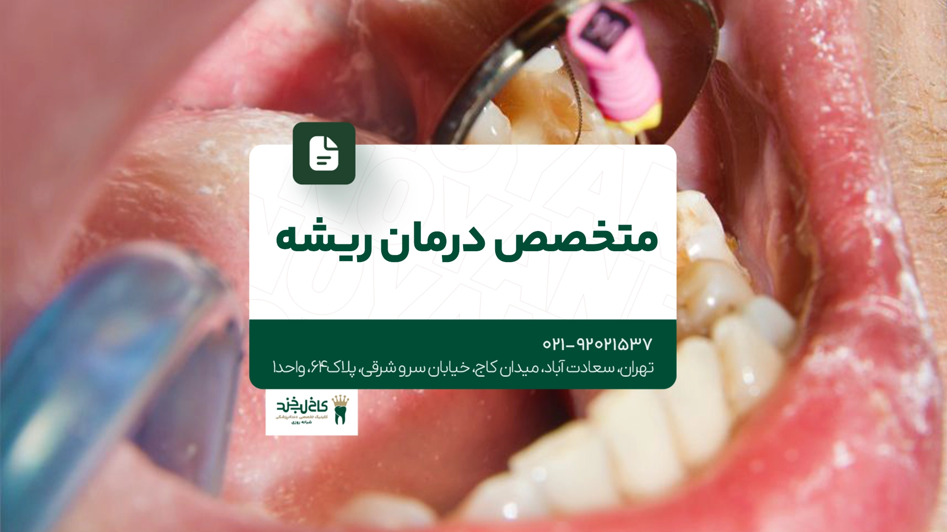 متخصص درمان ریشه