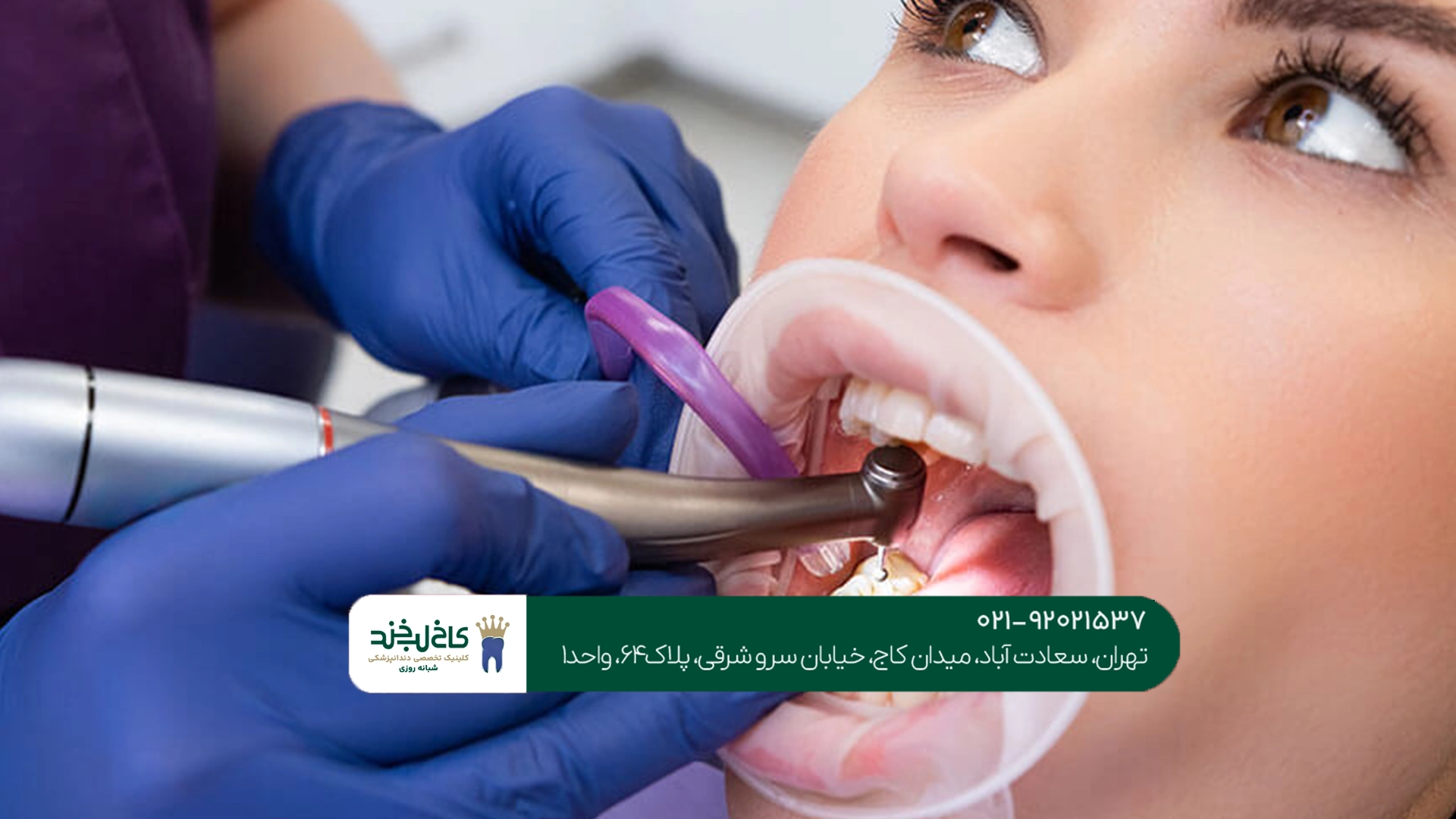 عصبکشی تخصصی دندان