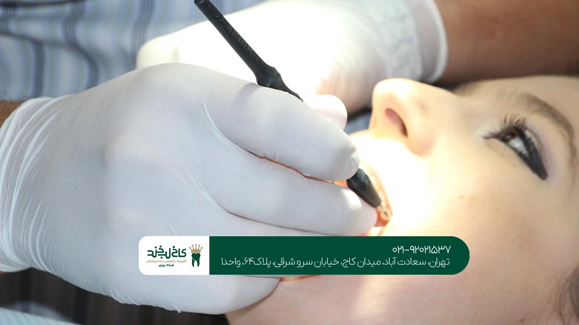 متخصص درمان ریشه در تهران متخصص درمان ریشه در تهران