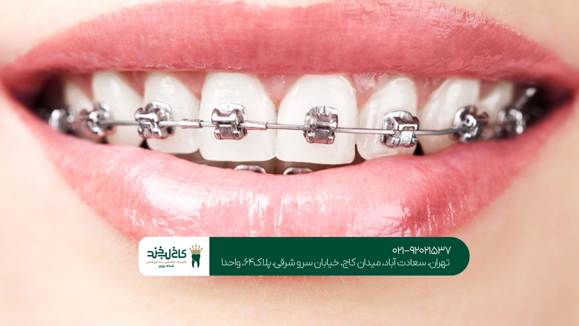 بهترین مرکز ارتودنسی