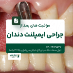 مراقبت های بعد از جراحی ایمپلنت دندان
