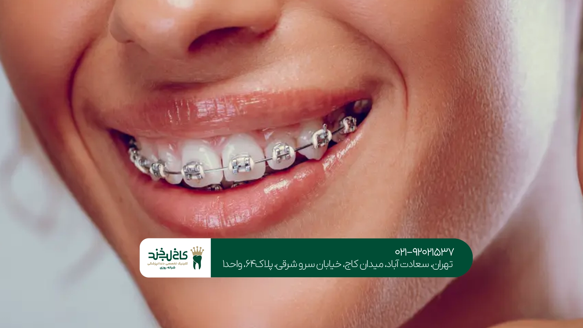 بهترین غذاها در دوران ارتودنسی بهترین غذاها در دوران ارتودنسی