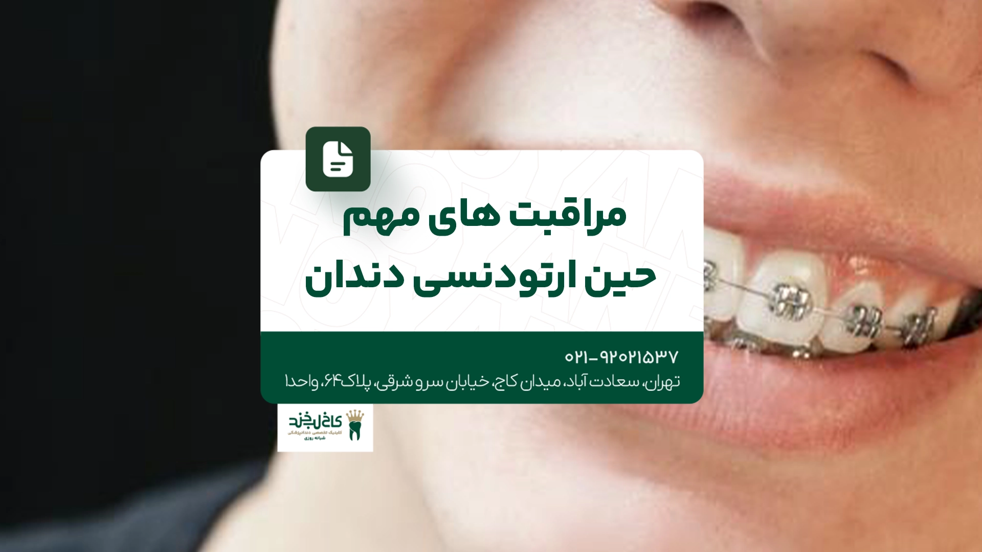 مراقبت های مهم حین ارتودنسی دندان مراقبت های مهم حین ارتودنسی دندان