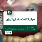 مرکز کاشت دندان تهران