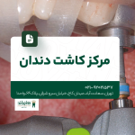 مرکز کاشت دندان