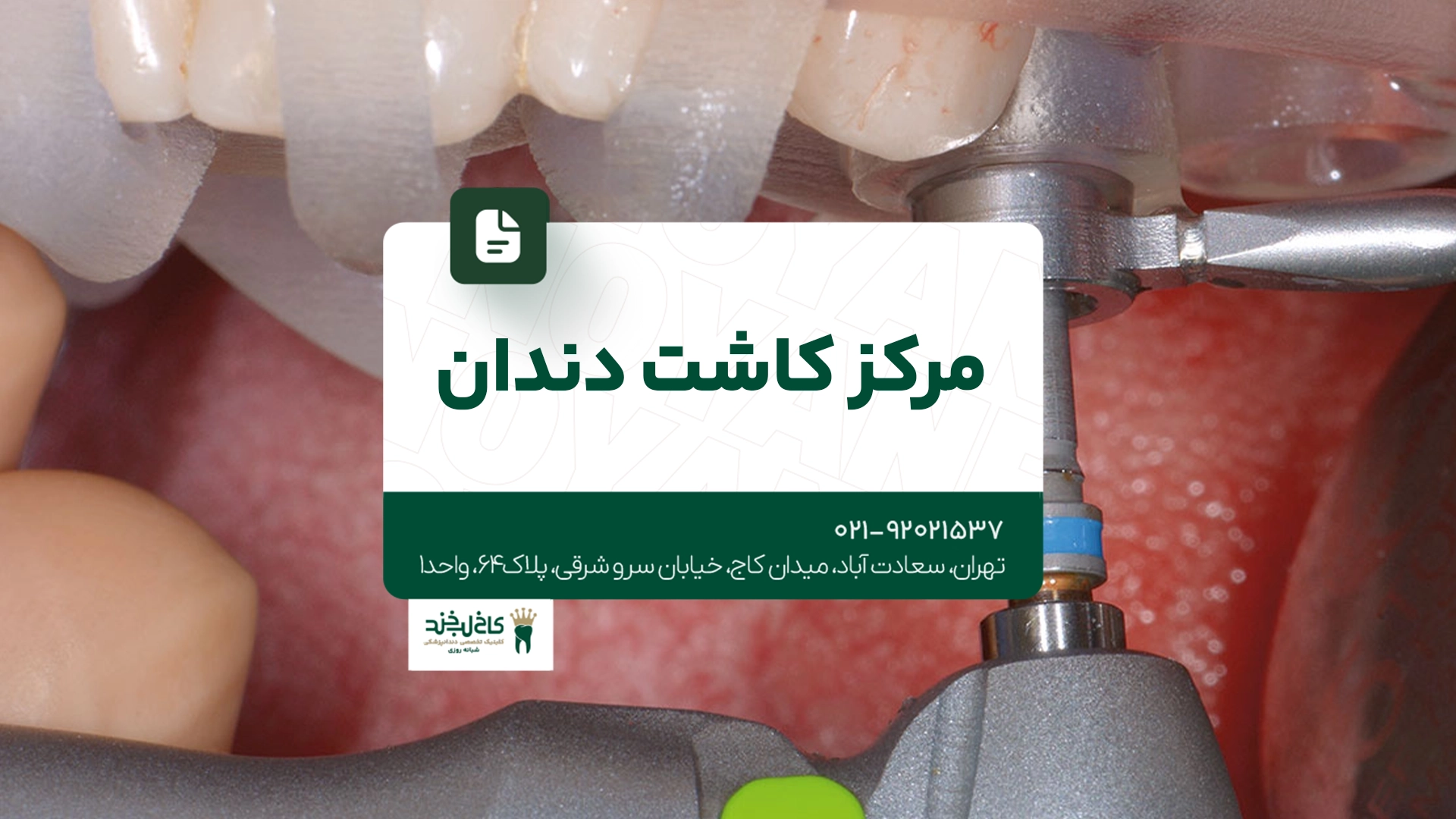 مرکز کاشت دندان