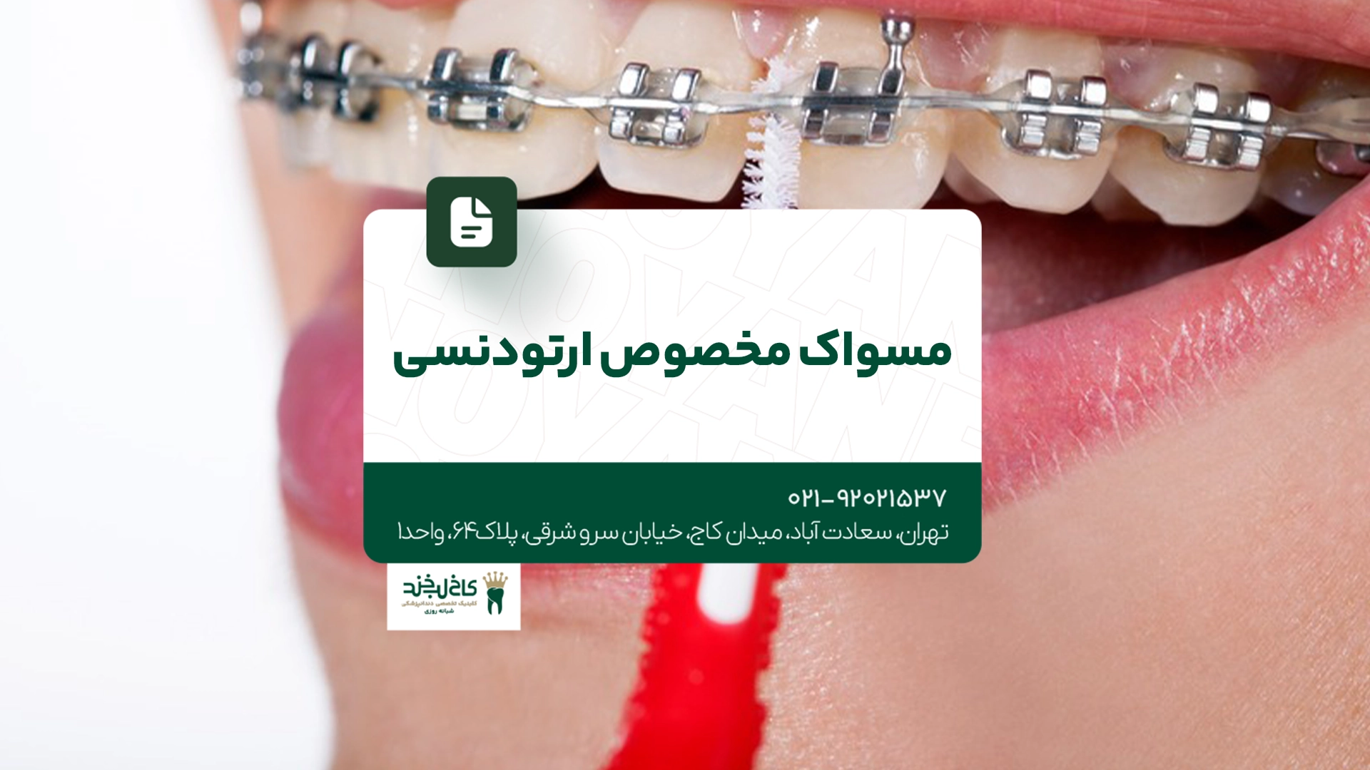 مسواک مخصوص ارتودنسی مسواک مخصوص ارتودنسی