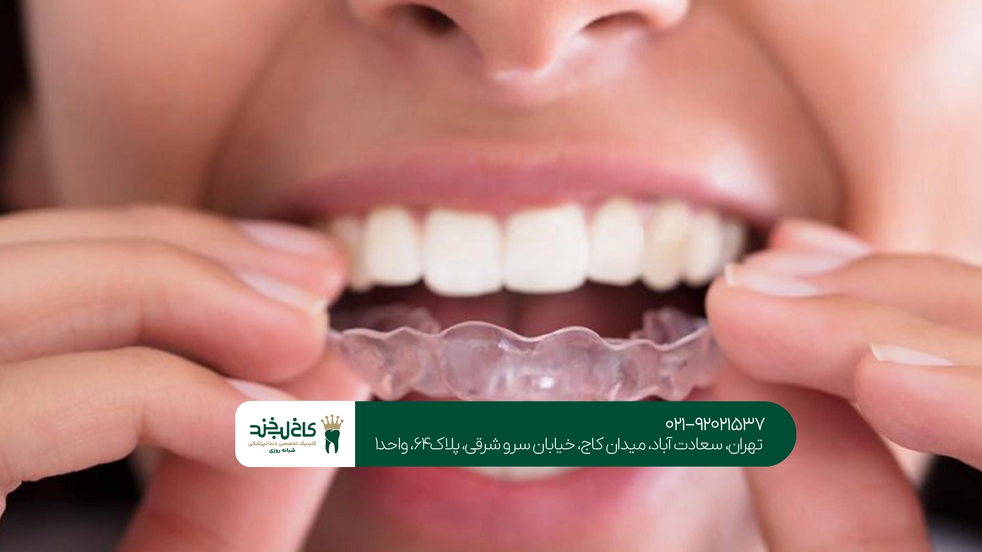 چه افرادی به نایت گارد نیاز دارند؟ چه افرادی به نایت گارد نیاز دارند؟