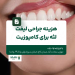 هزینه جراحی لیفت لثه برای کامپوزیت