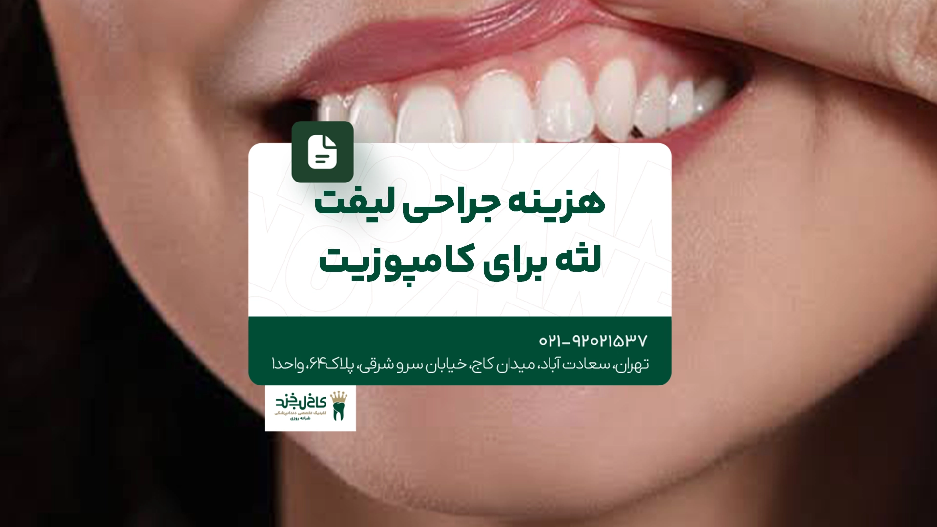 هزینه جراحی لیفت لثه برای کامپوزیت