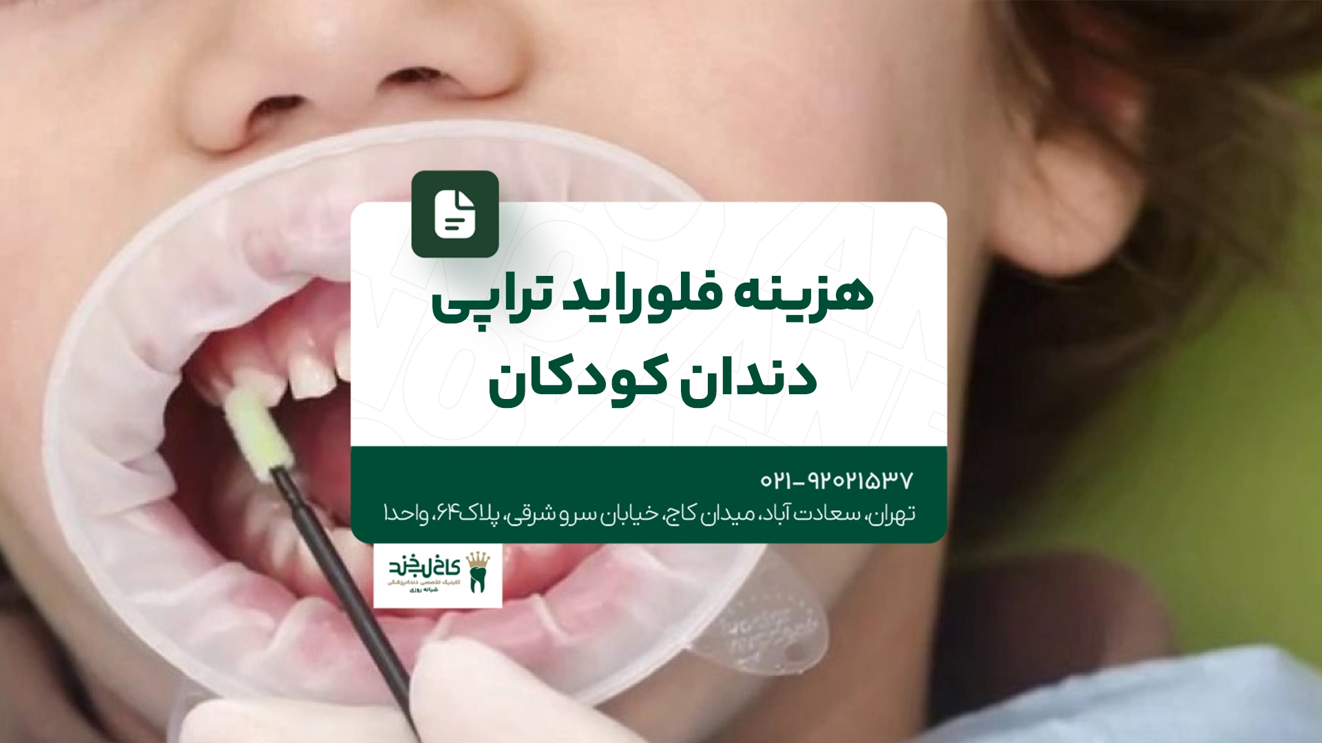 هزینه فلوراید تراپی دندان کودکان