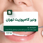ونیر کامپوزیت تهران