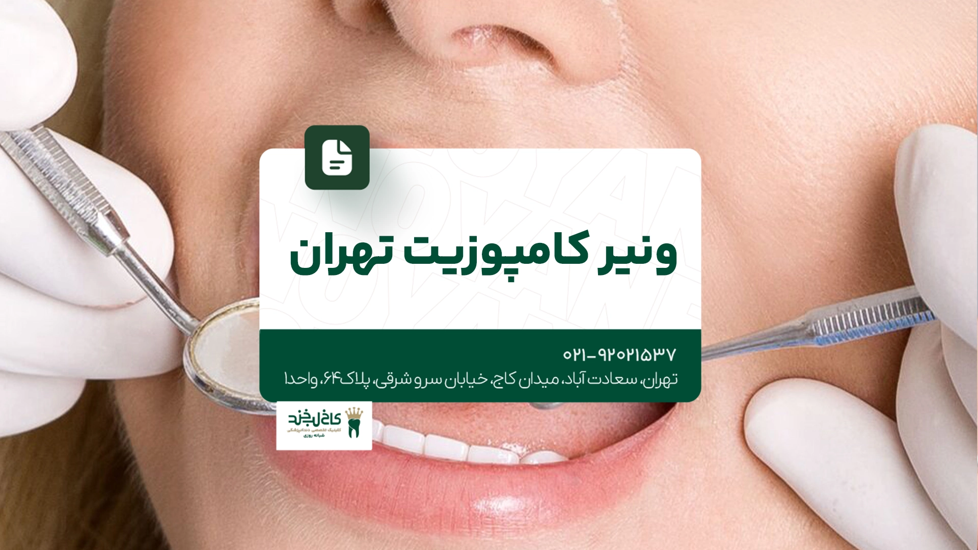 ونیر کامپوزیت تهران
